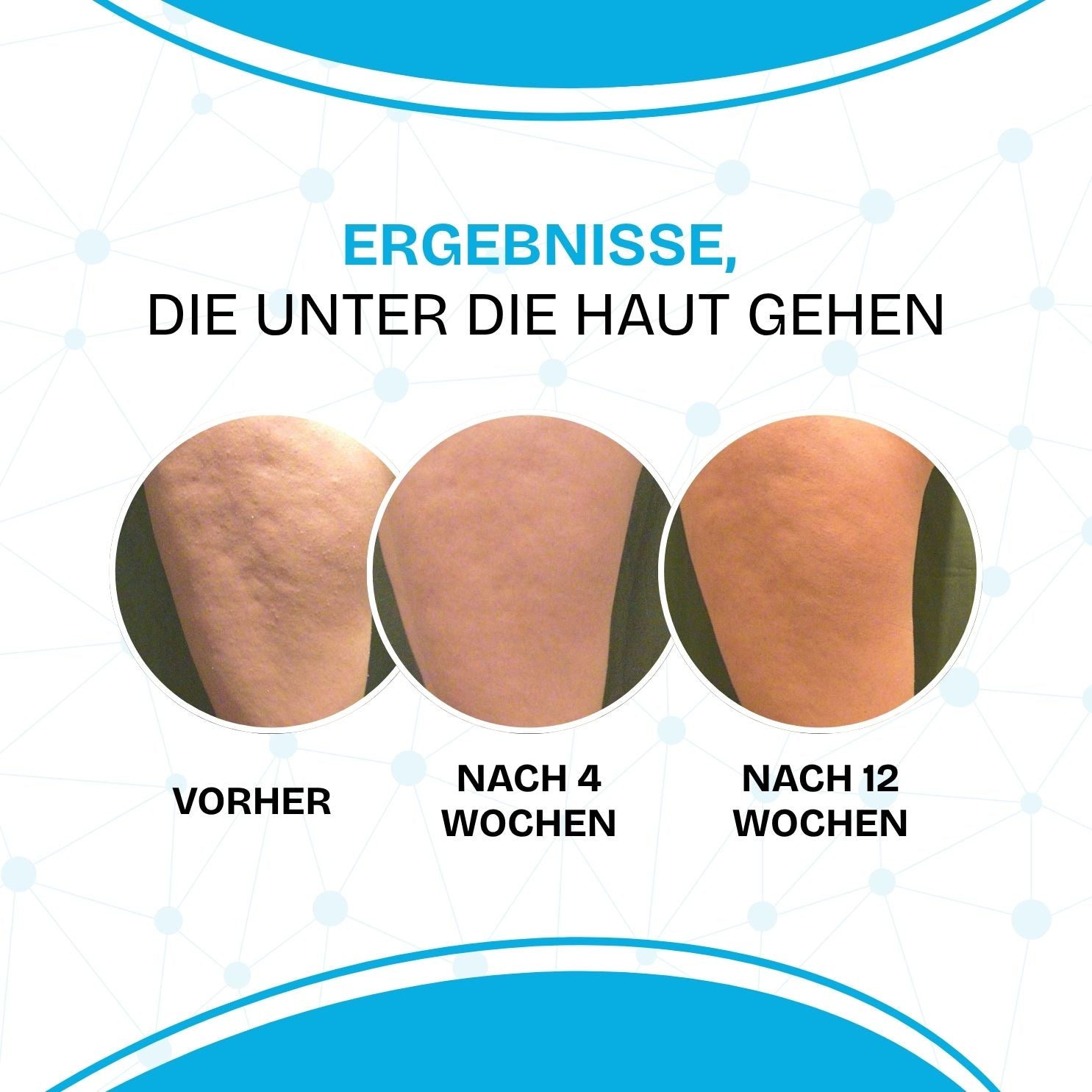 Solution – Das Serum gegen Cellulite, Volumen & Hautunebenheiten